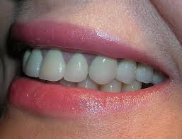 estetica dental mislata