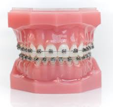 blanqueamientos mislata